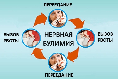 Лечение булимии в Ефремове